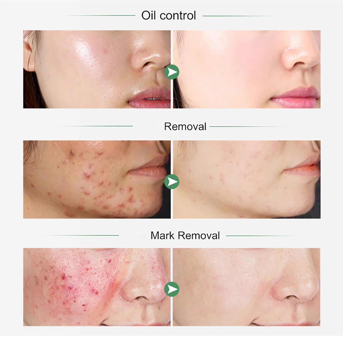 Organic Turmeric Skin Set