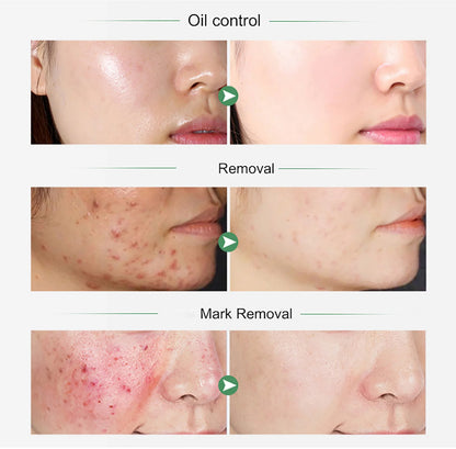 Organic Turmeric Skin Set