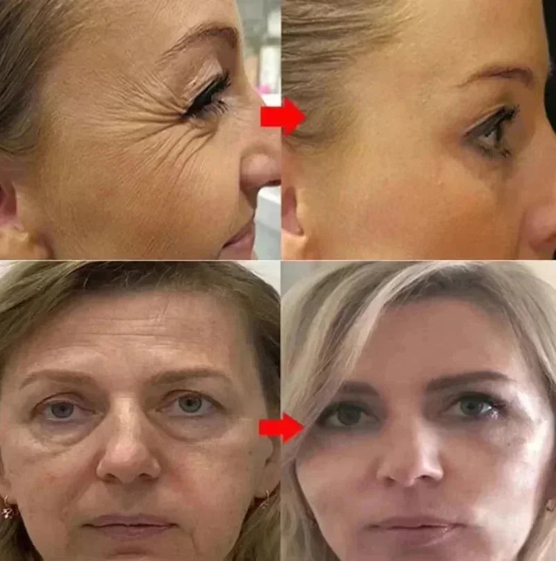 Before and after comparison of a woman's face with visible aging signs.