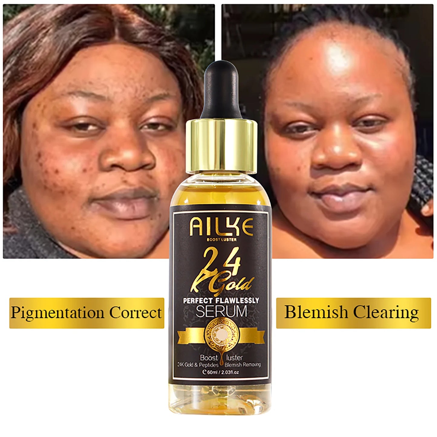 A bottle of AIKE 24K Gold Serum with before and after images of a woman's face.