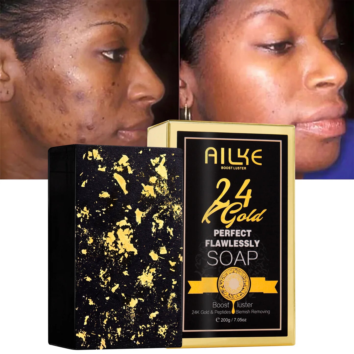 Ailye 24K Gold Perfect Flawlessly Soap packaging with a side view of a woman's face showing skin improvement.