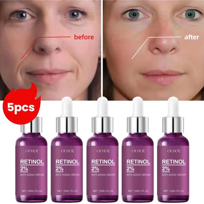 Before and after comparison of a face with Ouchie Retinol 2% serum bottles displayed below.