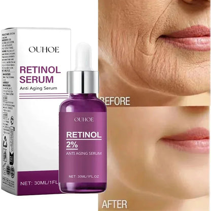 OUHOE Retinol Serum packaging and bottle with 'Before' and 'After' skin comparison.